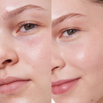 PURE U. - CONCEALER BALM 5g - WERTE FREUNDE