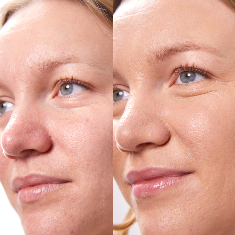 PURE U. - CONCEALER BALM 5g - WERTE FREUNDE