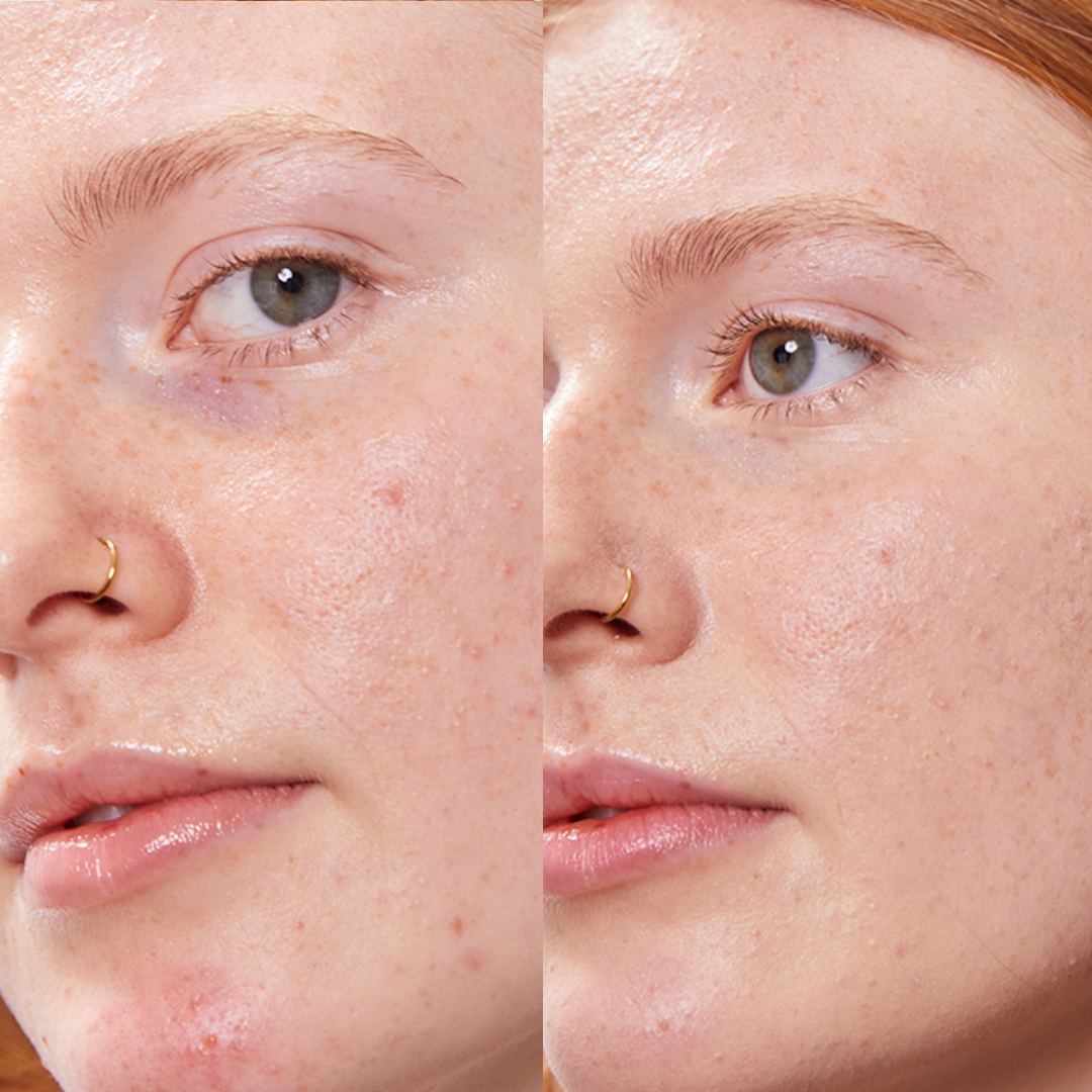 PURE U. - CONCEALER BALM 5g - WERTE FREUNDE