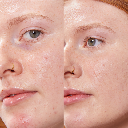 PURE U. - CONCEALER BALM 5g - WERTE FREUNDE