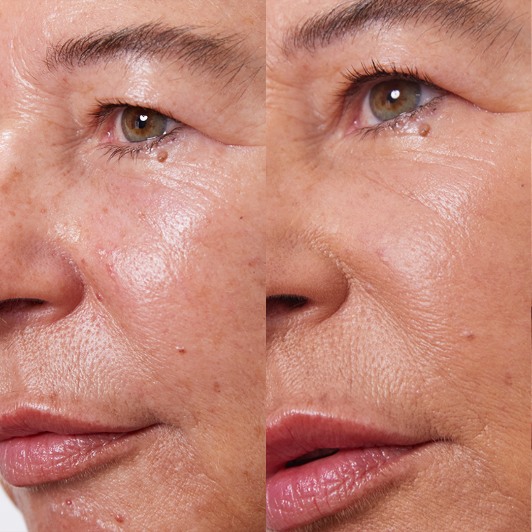 PURE U. - CONCEALER BALM 5g - WERTE FREUNDE